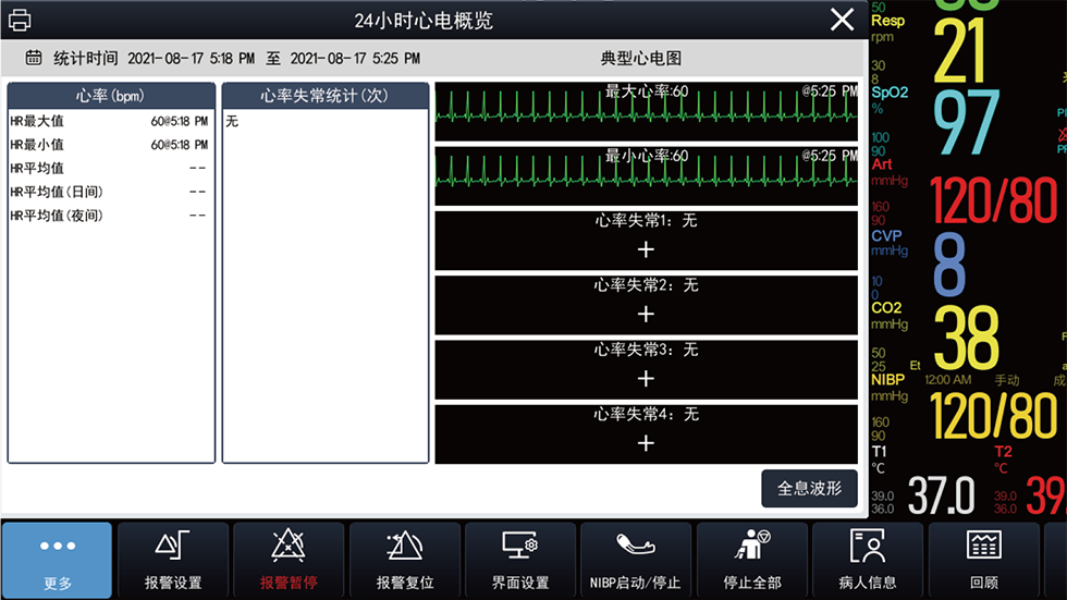 24小時(shí)心電概覽